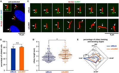 ALMS1 Regulates TGF-β Signaling and Morphology of Primary Cilia